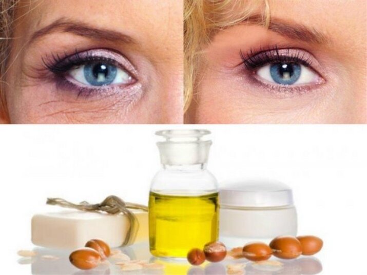 Как убрать морщины под глазами? | блог expert clinics
