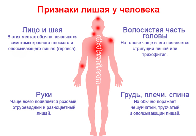 Сложное удаление зуба мудрости: показания, анестезия, этапы операции. особенности экстракции на верхней и нижней челюсти.